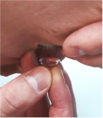 Person holding their eye open to insert a contact lens