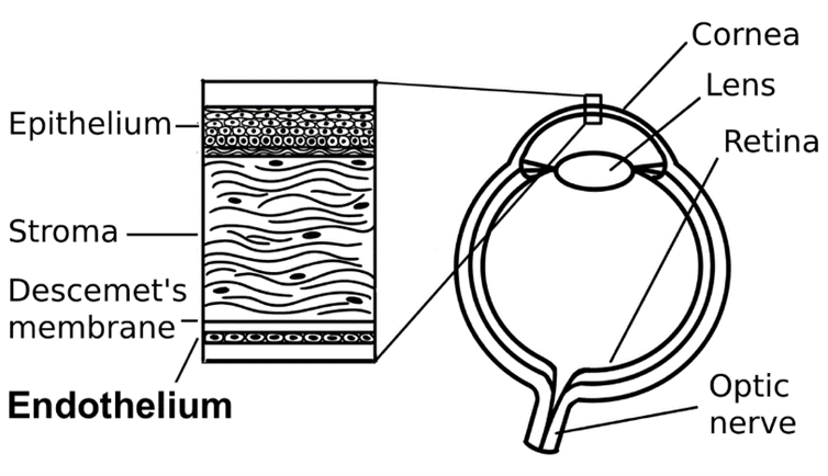 Black and white diagram of Fuchs’ Endothelial Corneal Dystrophy
