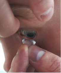 Fingers holding an eye open and inserting a contact lens