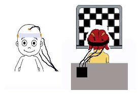 Diagram of visual evoked potential