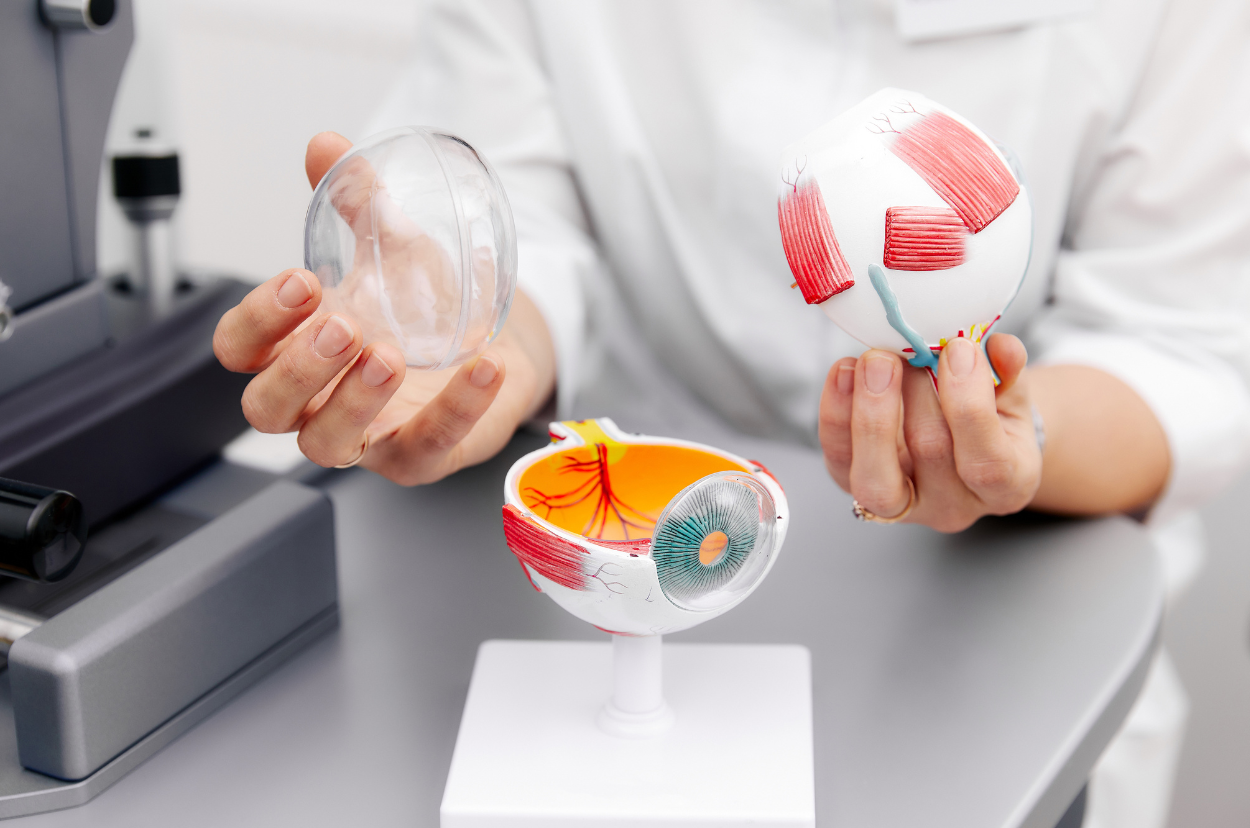 A health professional holding parts of the eye model