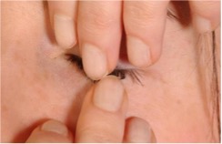 Fingers placed over a closed eye