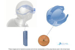 Diagram of the prima system 